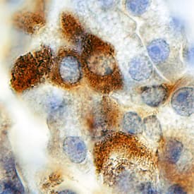 Immunohistochemistry Carbohydrate Sulfotransferase 3/CHST3 Antibody (799011)