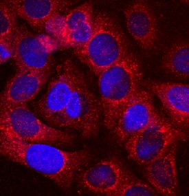 Immunocytochemistry alpha 1-Microglobulin Antibody (784917)