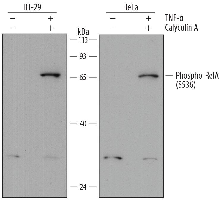 Western blot shows lysates of HT-29 human colon adenocarcinoma cell line and HeLa human cervical epithelial carcinoma cell line untreated (-) or treated (+) with 100 nM Calyculin A (Catalog # 1336) and 20 ng/mL Recombinant Human TNF-a (Catalog # 210-TA) for 10 minutes. PVDF membrane was probed with 2 µg/mL of Mouse Anti-Human Phospho-RelA/NF kappa B p65 (S536) Monoclonal Antibody (Catalog # MAB7226) followed by HRP-conjugated Anti-Mouse IgG Secondary Antibody (Catalog # HAF018). A specific band was detected for Phospho-RelA/ NF kappa B p65 (S536) at approximately 65 kDa (as indicated). This experiment was conducted under reducing conditions and using Immunoblot Buffer Group 2.