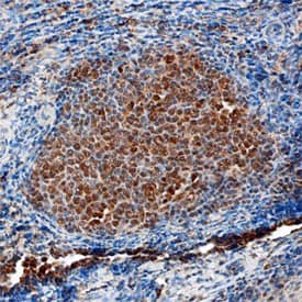 IRF8 was detected in immersion fixed paraffin-embedded sections of human tonsil using Mouse Anti-Human IRF8 Monoclonal Antibody (Catalog # MAB5117) at 15 µg/mL overnight at 4 °C. Before incubation with the primary antibody, tissue was subjected to heat-induced epitope retrieval using Antigen Retrieval Reagent-Basic (Catalog # CTS013). Tissue was stained using the Anti-Mouse HRP-DAB Cell & Tissue Staining Kit (brown; Catalog # CTS002) and counterstained with hematoxylin (blue). Specific staining was localized to lymphocytes in germinal centers. View our protocol for Chromogenic IHC Staining of Paraffin-embedded Tissue Sections.