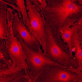 MCAM/CD146 was detected in immersion fixed bEnd.3 mouse endothelioma cell line using Rat Anti-Mouse MCAM/CD146 Monoclonal Antibody (Catalog # MAB7718) at 10 µg/mL for 3 hours at room temperature. Cells were stained using the Northern-Lights™ 557-conjugated Anti-Rat IgG Secondary Antibody (red; Catalog # NL013) and counterstained with DAPI (blue). Specific staining was localized to cell surfaces and cytoplasm. View our protocol for Fluorescent ICC Staining of Cells on Coverslips.
