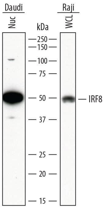 Western blot shows lysates of Daudi human Burkitt's lymphoma cell line and Raji human Burkitt's lymphoma cell line. Gels were loaded with 25 µg of nuclear extracts (Nuc) and whole cell lysate (WCL). PVDF membrane was probed with 2 µg/mL of Mouse Anti-Human IRF8 Monoclonal Antibody (Catalog # MAB5117) followed by HRP-conjugated Anti-Mouse IgG Secondary Antibody (Catalog # HAF007). A specific band was detected for IRF8 at approximately 50 kDa (as indicated). This experiment was conducted under reducing conditions and using Immunoblot Buffer Group 1.