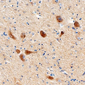 Immunohistochemistry ALK/CD246 Antibody [Unconjugated]