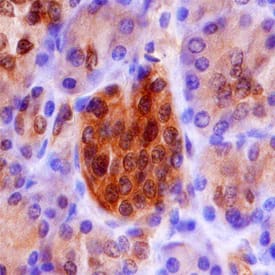 Endophilin B1/B2 was detected in immersion fixed paraffin-embedded sections of human pancreas using Mouse Anti-Human Endophilin B1/B2 Monoclonal Antibody (Catalog # MAB7456) at 15 µg/mL overnight at 4 °C. Before incubation with the primary antibody, tissue was subjected to heat-induced epitope retrieval using Antigen Retrieval Reagent-Basic (Catalog # CTS013). Tissue was stained using the Anti-Mouse HRP-DAB Cell & Tissue Staining Kit (brown; Catalog # CTS002) and counter-stained with hematoxylin (blue). Specific staining was localized to cytoplasm of islet cells. View our protocol for Chromogenic IHC Staining of Paraffin-embedded Tissue Sections.