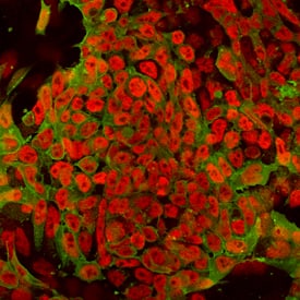 Immunocytochemistry UTF1 Antibody