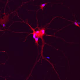 Complexin-1/2 was detected in immersion fixed rat hippocampal neurons (14 daysin vitro) using Goat Anti-Human/ Mouse/Rat Complexin-1/2 Antigen Affinity-purified Polyclonal Antibody (Catalog # AF7787) at 10 µg/mL for 3 hours at room temperature. Cells were stained using the Northern-Lights™ 557-conjugated Anti-Goat IgG Secondary Antibody (red; Catalog # NL001) and counterstained with DAPI (blue). Specific staining was localized to cytoplasm. View our protocol for Fluorescent ICC Staining of Cells on Coverslips.