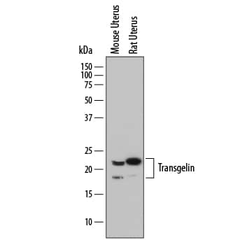 Western blot shows lysates of mouse uterus tissue and rat uterus tissue. PVDF membrane was probed with 0.5 µg/mL of Sheep Anti-Human/Mouse/Rat Transgelin/TAGLN Antigen Affinity-purified Polyclonal Antibody (Catalog # AF7886) followed by HRP-conjugated Anti-Sheep IgG Secondary Antibody (Catalog # HAF016). Specific bands were detected for Transgelin/TAGLN at approximately 18-22 kDa (as indicated). This experiment was conducted under reducing conditions and using Immunoblot Buffer Group 1.