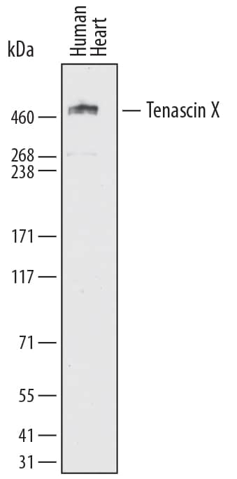 Western Blot Tenascin X Antibody (766842) [Unconjugated]