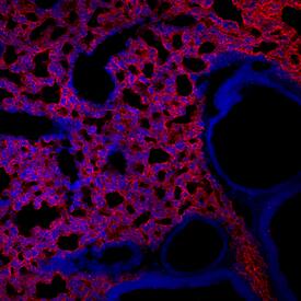 RAGE was detected in perfusion fixed frozen sections of adult mouse lung using Rat Anti-Mouse/Rat RAGE Monoclonal Antibody (Catalog # MAB1179) at 10 µg/mL overnight at 4 °C. Tissue was stained using the Northern-Lights™ 557-conjugated Anti-Rat IgG Secondary Antibody (red; Catalog # NL013) and counterstained with DAPI (blue). View our protocol for Fluorescent IHC Staining of Frozen Tissue Sections.