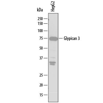 Western blot shows lysates of HepG2 human hepatocellular carcinoma cell line. PVDF membrane was probed with 2 µg/mL of Mouse Anti-Human Glypican 3 Monoclonal Antibody (Catalog # MAB2119) followed by HRP-conjugated Anti-Mouse IgG Secondary Antibody (Catalog # HAF007). A specific band was detected for Glypican 3 at approximately 75 kDa (as indicated). This experiment was conducted under reducing conditions and using Immunoblot Buffer Group 1.