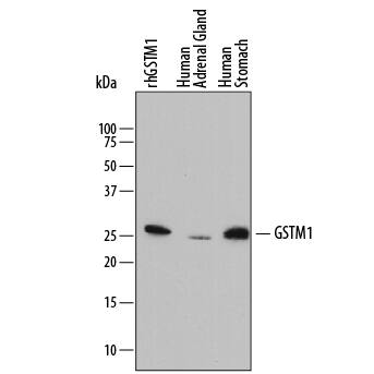 Western blot shows Recombinant Human GSTM1 (Catalog # 6894-GT, 3 ng/lane) and lysates of human adrenal gland tissue and human stomach tissue. PVDF membrane was probed with 1 µg/mL of Mouse Anti-Human Glutathione S-Transferase mu 1/GS Monoclonal Antibody (Catalog # MAB6894) followed by HRP-conjugated Anti-Mouse IgG Secondary Antibody (Catalog # HAF018). A specific band was detected for Glutathione S-Transferase mu 1/GS at approximately 25 kDa (as indicated). This experiment was conducted under reducing conditions and using Immunoblot Buffer Group 1.