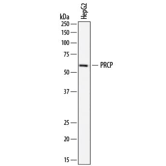 Western Blot Lysosomal Pro-X Carboxypeptidase/PRCP Antibody