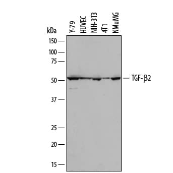 Western blot shows lysates of Y-79 human retinoblastoma cell line, HUVEC human umbilical vein endothelial cells, NIH-3T3 mouse embryonic fibroblast cell line, 4T1 mouse breast cancer cell line, and NMuMG mouse mammary gland epithelial cell line. PVDF membrane was probed with 2 µg/mL of Rat Anti-Mouse TGF-beta 2 Monoclonal Antibody (Catalog # MAB73461) followed by HRP-conjugated Anti-Rat IgG Secondary Antibody (Catalog # HAF005). A specific band was detected for TGF-beta 2 at approximately 52 kDa (as indicated). This experiment was conducted under reducing conditions and using Immunoblot Buffer Group 1.