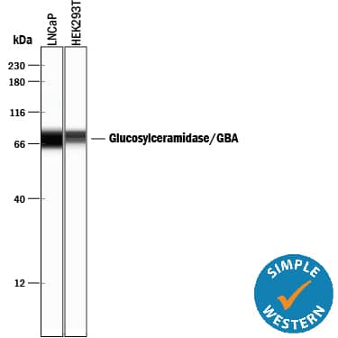 Simple Western lane view shows lysates of LNCaP human prostate cancer cell line and HEK293T human embryonic kidney cell line, loaded at 0.2 mg/mL. A specific band was detected for Glucosylceramidase/GBA at approximately 77 kDa (as indicated) using 10 µg/mL of Mouse Anti-Human Glucosylceramidase/GBA Monoclonal Antibody (Catalog # MAB7410). This experiment was conducted under reducing conditions and using the 12-230 kDa separation system.