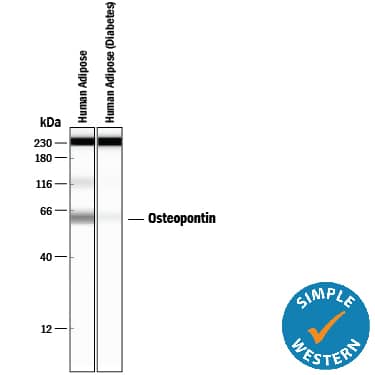 Simple Western lane view shows lysates of human adipose tissue and human adipose (diabetes) tissue, loaded at 0.2 mg/mL. A specific band was detected for Osteopontin/OPN at approximately 63 kDa (as indicated) using 100 µg/mL of Mouse Anti-Human Osteopontin/OPN Monoclonal Antibody (Catalog # MAB14331). This experiment was conducted under reducing conditions and using the 12-230 kDa separation system.*Non-specific interaction with the 230 kDa Simple Western standard may be seen with this antibody.