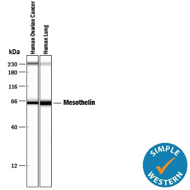Simple Western lane view shows lysates of human ovarian cancer tissue and human lung tissue, loaded at 0.2 mg/mL. A specific band was detected for Mesothelin at approximately 65 kDa (as indicated) using 20 µg/mL of Mouse Anti-Human Mesothelin Monoclonal Antibody (Catalog # MAB32653). This experiment was conducted under reducing conditions and using the 12-230 kDa separation system.*Non-specific interaction with the 230 kDa Simple Western standard may be seen with this antibody.