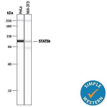 Simple Western lane view shows lysates of HeLa human cervical epithelial carcinoma cell line and NIH‑3T3 mouse embryonic fibroblast cell line, loaded at 0.2 mg/mL. A specific band was detected for STAT5b at approximately 92 kDa (as indicated) using 10 µg/mL of Rabbit Anti-Human/Mouse STAT5b Antigen Affinity-purified Polyclonal Antibody (Catalog # AF1584). This experiment was conducted under reducing conditions and using the 12-230 kDa separation system.Non-specific interaction with the 230 kDa Simple Western standard may be seen with this antibody.