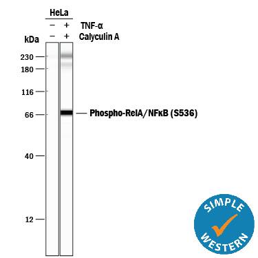 <b>Biological Strategies Validation. </b>Simple Western lane view shows lysates of HeLa human cervical epithelial carcinoma cell line untreated (-) or treated (+) with 100 nM Calyculin A (Catalog # 1336) and 20 ng/mL Recombinant Human TNF-a (Catalog # 210-TA) for 10 minutes, loaded at 0.2 mg/mL. A specific band was detected for Phospho-RelA/NF kappa B p65 (S536) at approximately 66 kDa (as indicated) using 1.0 µg/mL of Rabbit Anti-Human Phospho-RelA/NF kappa B p65 (S536) Monoclonal Antibody (Catalog # MAB72261). This experiment was conducted under reducing conditions and using the 12-230 kDa separation system.Non-specific interaction with the 230 kDa Simple Western standard may be seen with this antibody.