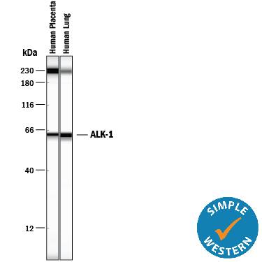 Simple Western ALK-1 Antibody (117720)
