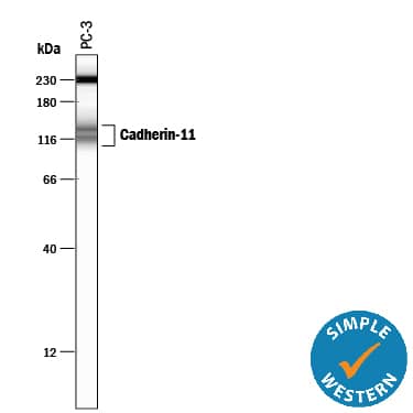 Simple Western Cadherin-11 Antibody (283416)