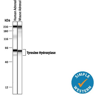 Simple Western Tyrosine Hydroxylase Antibody (779427)