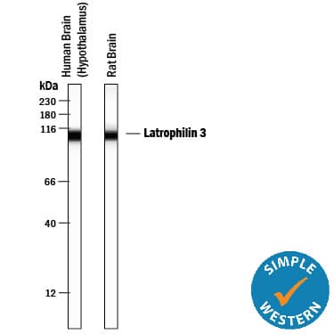 Simple Western lane view shows lysates of human brain (hypothalamus) tissue and rat brain tissue, loaded at 0.5 mg/mL. A specific band was detected for Latrophilin 3/LPHN3 at approximately 109 kDa (as indicated) using 20 µg/mL of Mouse Anti-Human/Mouse/Rat Latrophilin 3/LPHN3 Monoclonal Antibody (Catalog # MAB5916). This experiment was conducted under reducing conditions and using the 12-230 kDa separation system.