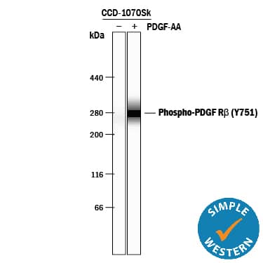 <b>Biological Strategies Validation. </b>Simple Western lane view shows lysates of CCD-1070Sk human foreskin fibroblast cell line untreated (-) or treated (+) with 100 ng/mL Recombinant Human PDGF-AA (Catalog # 221-AA) for 10 minutes, loaded at 0.2 mg/mL. A specific band was detected for Phospho-PDGF R beta  (Y751) at approximately 274 kDa (as indicated) using 5 µg/mL of Rabbit Anti-Human Phospho-PDGF R beta  (Y751) Antigen Affinity-purified Polyclonal Antibody (Catalog # AF1767). This experiment was conducted under reducing conditions and using the 66-440 kDa separation system.