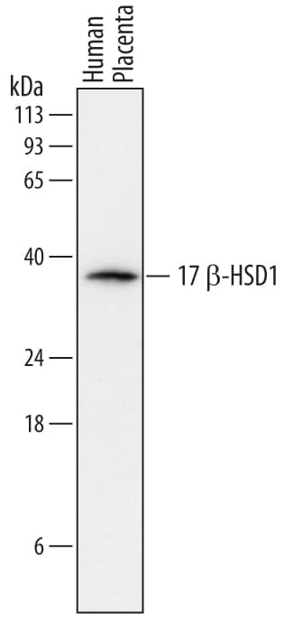Western Blot 17 beta-HSD1/HSD17B1 Antibody [Unconjugated]