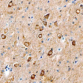 Immunohistochemistry 17 beta-HSD1/HSD17B1 Antibody [Unconjugated]