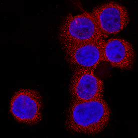 Immunocytochemistry 20S Immunoproteasome Antibody (894510) [Unconjugated]