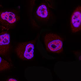 20S Proteasome was detected in immersion fixed A549 human lung carcinoma cell line using Mouse Anti-Human 20S Proteasome Monoclonal Antibody (Catalog # MAB9554) at 8 µg/mL for 3 hours at room temperature. Cells were stained using the NorthernLights™ 557-conjugated Anti-Mouse IgG Secondary Antibody (red; Catalog # NL007) and counterstained with DAPI (blue). Specific staining was localized to cytoplasm. View our protocol for Fluorescent ICC Staining of Cells on Coverslips.