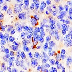 4-1BB/TNFRSF9/CD137 was detected in immersion fixed paraffin-embedded sections of human tonsil using Goat Anti-Human 4-1BB/TNFRSF9/CD137 Antigen Affinity-purified Polyclonal Antibody (Catalog # AF838) at 10 µg/mL overnight at 4 °C. Tissue was stained using the Anti-Goat HRP-DAB Cell & Tissue Staining Kit (brown; CTS008) and counterstained with hematoxylin (blue). Specific staining was localized to lymphocytes. View our protocol for Chromogenic IHC Staining of Paraffin-embedded Tissue Sections.