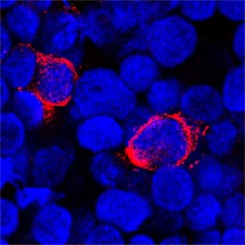 4-1BB/TNFRSF9/CD137 was detected in immersion fixed human peripheral blood mononuclear cells (PBMCs) using Goat Anti-Human 4-1BB/TNFRSF9/CD137 Biotinylated Antigen Affinity-purified Polyclonal Antibody (Catalog # BAF838) at 15 µg/mL for 3 hours at room temperature. Cells were stained using the NorthernLights™ 557-conjugated Streptavidin (red ; Catalog # NL999) and counterstained with DAPI (blue). Specific staining was localized to plasma membrane and cytoplasm. View our protocol for Fluorescent ICC Staining of Cells on Coverslips.
