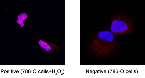 PAR/pADPr was detected in immersion fixed 786‑O human renal cell adenocarcinoma cell line untreated (negative) or treated (positive) with 2mM hydrogen peroxide for 5 minutes using Mouse Anti-PAR/pADPr Monoclonal Antibody (Catalog # 4335-MC-100) at 3 µg/ml for 3 hours at room temperature. Cells were stained using the NorthernLights™ 557-conjugated Anti-Mouse IgG Secondary Antibody (red; Catalog # NL007) and counterstained with DAPI (blue). Specific staining was localized to the nucleus upon stimulation with hydrogen peroxide. View our protocol for Fluorescent ICC Staining of Cells on Coverslips.