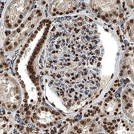 PAR/pADPr was detected in immersion fixed paraffin-embedded sections of human kidney using Mouse Anti-PAR/pADPr Monoclonal Antibody (Catalog # 4335-MC-100) at 1.7 µg/ml for 1 hour at room temperature followed by incubation with the Anti-Mouse IgG VisUCyte™ HRP Polymer Antibody (Catalog # VC001). Before incubation with the primary antibody, tissue was subjected to heat-induced epitope retrieval using VisUCyte Antigen Retrieval Reagent-Basic (Catalog # VCTS021). Tissue was stained using DAB (brown) and counterstained with hematoxylin (blue). Specific staining was localized to the nucleus. View our protocol for IHC Staining with VisUCyte HRP Polymer Detection Reagents.