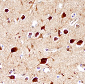 Immunohistochemistry 5-HT2C Antibody (496214) [Unconjugated]