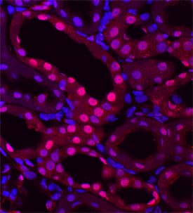 53BP1 was detected in perfusion fixed frozen sections of rat kidney using Goat Anti-Human 53BP1 Antigen Affinity-purified Polyclonal Antibody (Catalog # AF1877) at 15 µg/mL overnight at 4 °C. Tissue was stained using the NorthernLights™ 557-conjugated Anti-Goat IgG Secondary Antibody (red; Catalog # NL001) and counterstained with DAPI (blue). Specific staining was localized to nuclei of epithelial cells in convoluted tubules. View our protocol for Fluorescent IHC Staining of Frozen Tissue Sections.