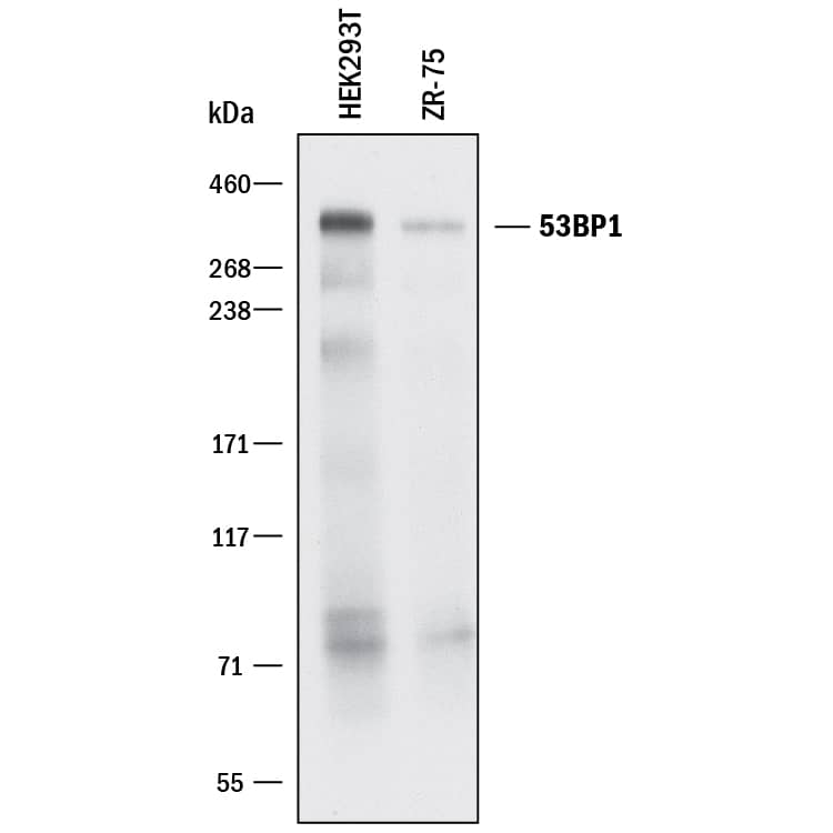 Western blot shows lysates of HEK293T human embryonic kidney cell line and ZR-75 human breast cancer cell line. PVDF membrane was probed with 1 µg/mL of Goat Anti-Human 53BP1 Antigen Affinity-purified Polyclonal Antibody (Catalog # AF1877) followed by HRP-conjugated Anti-Goat IgG Secondary Antibody (Catalog # HAF017). A specific band was detected for 53BP1 at approximately 350 kDa (as indicated). This experiment was conducted under reducing conditions and using Immunoblot Buffer Group 1.