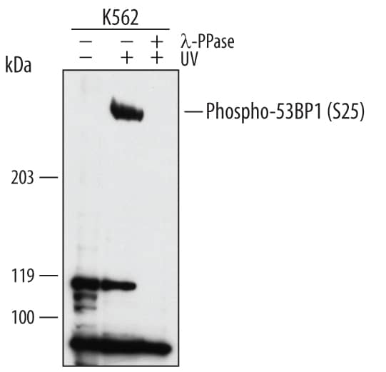 Western blot shows lysates of K562 human chronic myelogenous leukemia cell line untreated (-) or exposed (+) to 50 J/m2UV-C and allowed 1 hour recovery time. PVDF membrane was probed with 1 µg/mL Rabbit Anti-Human Phospho-53BP1 (S25) Antigen Affinity-purified Polyclonal Antibody (Catalog # AF3405) followed by HRP-conjugated Anti-Rabbit IgG Secondary Antibody (Catalog # HAF008). A specific band for Phospho-53BP1 (S25) was detected at approximately 450 kDa (as indicated). The phospho-specificity of this antibody was supported by decreased labeling following treatment with 600 U lambda-phosphatase (lambda-PPase) for 1 hour. This experiment was conducted under reducing conditions and using Immunoblot Buffer Group 1.