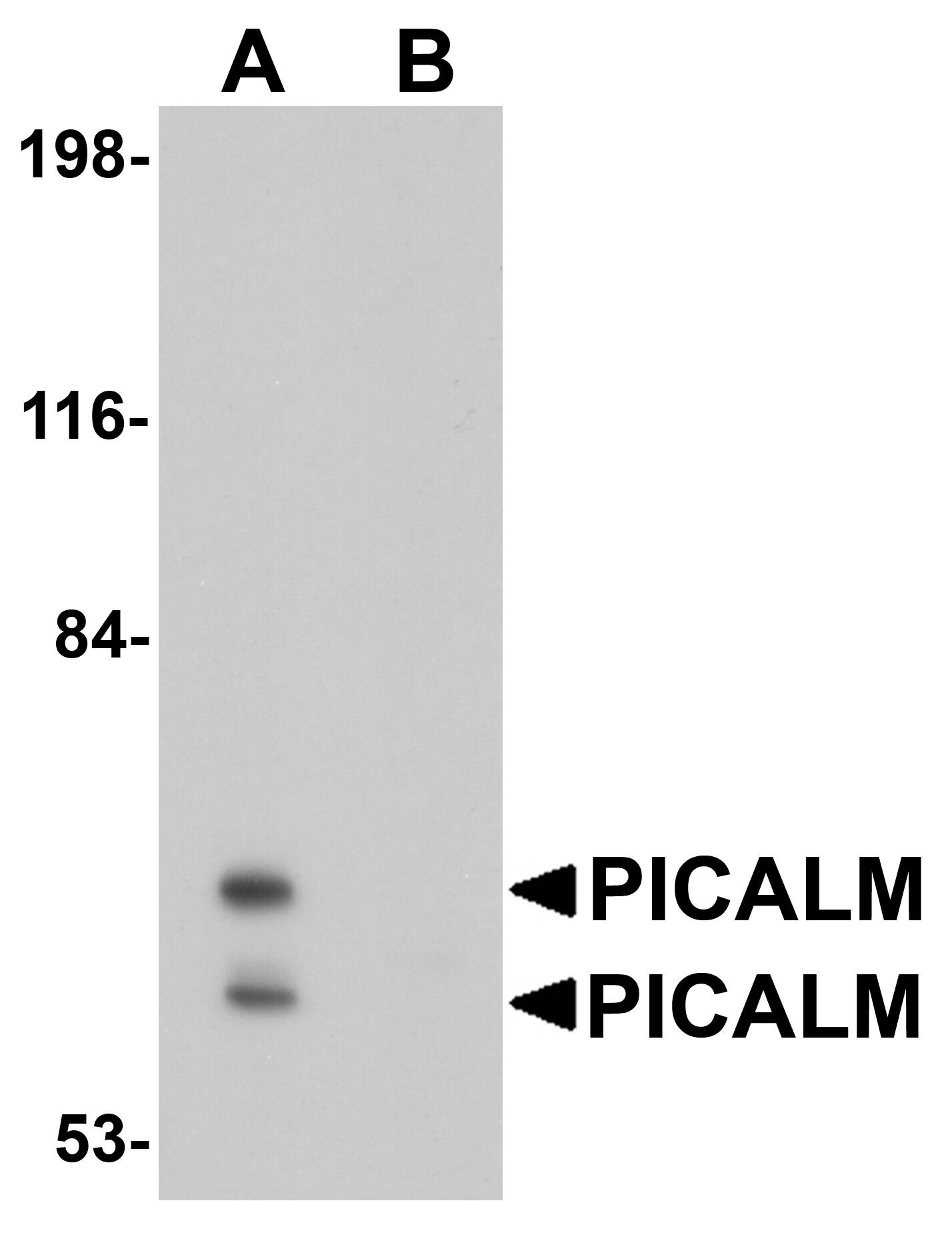 Western Blot: PICALM Antibody - BSA Free [NBP1-76254] - EL4 cell lysate with PICALM antibody at 1 ug/mL in (A) the absence and (B) the presence of blocking peptide.