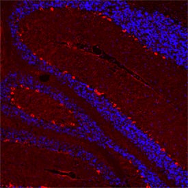 Immunohistochemistry 5-HT2B Antibody (1014838) [Unconjugated]