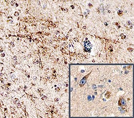 5-HT4 was detected in immersion fixed paraffin-embedded sections of human brain (cortex) using Mouse Anti-Human 5-HT4 Monoclonal Antibody (Catalog # MAB6545) at 15 µg/mL for 1 hour at room temperature followed by incubation with the Anti-Mouse IgG VisUCyte™ HRP Polymer Antibody (Catalog # VC001). Before incubation with the primary antibody, tissue was subjected to heat-induced epitope retrieval using Antigen Retrieval Reagent-Basic (Catalog # CTS013). Tissue was stained using DAB (brown) and counterstained with hematoxylin (blue). Specific staining was localized to neuronal cell bodies and processes. View our protocol for IHC Staining with VisUCyte HRP Polymer Detection Reagents.