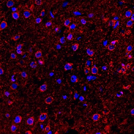 5-HT6 was detected in perfusion fixed frozen sections of rat brain (medulla) using Rabbit Anti-Human 5-HT6 Monoclonal Antibody (Catalog # MAB9496) at 1.7 µg/mL overnight at 4 °C. Tissue was stained using the NorthernLights™ 557-conjugated Anti-Rabbit IgG Secondary Antibody (red; Catalog # NL004) and counterstained with DAPI (blue). Specific staining was localized to cytoplasm of neuronal cell bodies. View our protocol for Fluorescent IHC Staining of Frozen Tissue Sections.