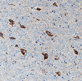 5-HT7 was detected in immersion fixed paraffin-embedded sections of human brain (hypothalamus) using Mouse Anti-Human 5-HT7 Monoclonal Antibody (Catalog # MAB10325) at 5 µg/mL for 1 hour at room temperature followed by incubation with the Anti-Mouse IgG VisUCyte™ HRP Polymer Antibody (Catalog # VC001). Before incubation with the primary antibody, tissue was subjected to heat-induced epitope retrieval using Antigen Retrieval Reagent-Basic (Catalog # CTS013). Tissue was stained using DAB (brown) and counterstained with hematoxylin (blue). Specific staining was localized to cell membrane and cytoplasm in neurons. View our protocol for IHC Staining with VisUCyte HRP Polymer Detection Reagents.