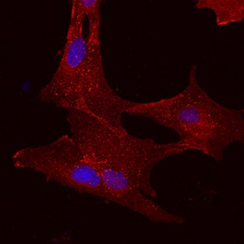 Immunocytochemistry 5'-Nucleotidase/CD73 Antibody [Unconjugated]