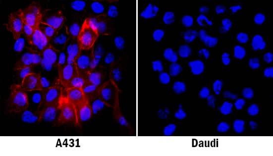 5'-Nucleotidase/CD73 was detected in immersion fixed A431 human epithelial carcinoma cell line using Sheep Anti-Human 5'-Nucleotidase/CD73 Antigen Affinity-purified Polyclonal Antibody (Catalog # AF5795) at 5 µg/mL for 3 hours at room temperature. Cells were stained using the NorthernLights™ 557-conjugated Anti-Sheep IgG Secondary Antibody (red; Catalog # NL010) and counterstained with DAPI (blue). Specific staining was localized to plasma membrane. View our protocol for Fluorescent ICC Staining of Cells on Coverslips.