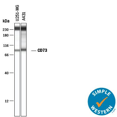 Simple Western lane view shows lysates of U‑251 MG human glioblastoma cell line and A431 human epithelial carcinoma cell line, loaded at 0.2 mg/mL. A specific band was detected for 5'‑Nucleotidase/CD73 at approximately 86 kDa (as indicated) using 20 µg/mL of Mouse Anti-Human/Mouse/Rat 5'‑Nucleotidase/CD73 Monoclonal Antibody (Catalog # MAB57951) . This experiment was conducted under reducing conditions and using the 12-230 kDa separation system. Non-specific interaction with the 230 kDa Simple Western standard may be seen with this antibody.
