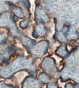 5T4 was detected in immersion fixed paraffin-embedded sections of human placenta using 10 µg/mL Sheep Anti-Human 5T4 Antigen Affinity-purified Polyclonal Antibody (Catalog # AF4975) overnight at 4 °C. Before incubation with the primary antibody tissue was subjected to heat-induced epitope retrieval using Antigen Retrieval Reagent-Basic (Catalog # CTS013). Tissue was stained with the Anti-Sheep HRP-DAB Cell & Tissue Staining Kit (brown; Catalog # CTS019) and counterstained with hematoxylin (blue). View our protocol for Chromogenic IHC Staining of Paraffin-embedded Tissue Sections.