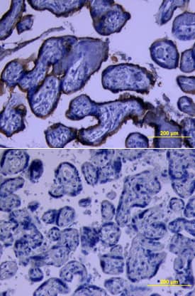 5T4 was detected in immersion fixed paraffin-embedded sections of human placenta using Sheep Anti-Human 5T4 Antigen Affinity-purified Polyclonal Antibody (Catalog # AF4975) at 10 µg/mL overnight at 4 °C. Tissue was stained using the Anti-Sheep HRP-DAB Cell & Tissue Staining Kit (brown; Catalog # CTS019) and counterstained with hematoxylin (blue). Lower panel shows a lack of labeling if primary antibodies are omitted and tissue is stained only with secondary antibody followed by incubation with detection reagents. View our protocol for Chromogenic IHC Staining of Paraffin-embedded Tissue Sections.