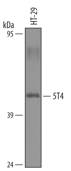 Western blot shows lysates of HT-29 human colon adenocarcinoma cell line. PVDF membrane was probed with 1 µg/mL of Sheep Anti-Human 5T4 Antigen Affinity-purified Polyclonal Antibody (Catalog # AF4975) followed by HRP-conjugated Anti-Sheep IgG Secondary Antibody (Catalog # HAF016). A specific band was detected for 5T4 at approximately 50 kDa (as indicated). This experiment was conducted under reducing conditions and using Immunoblot Buffer Group 8.